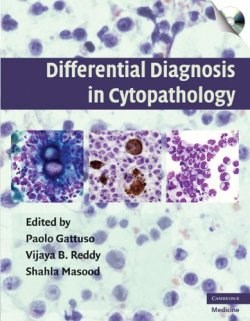 Differential Diagnosis in Cytopathology with CD-ROM (ISBN: 9780521873383)